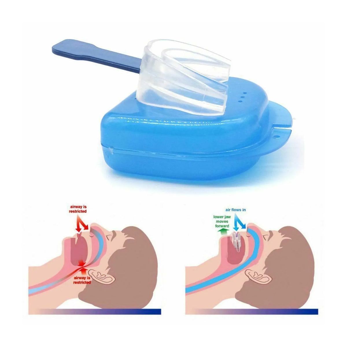 Social Hike Anti Snoring Aid Mouth Guard Adjustable For Sleeping Breathing