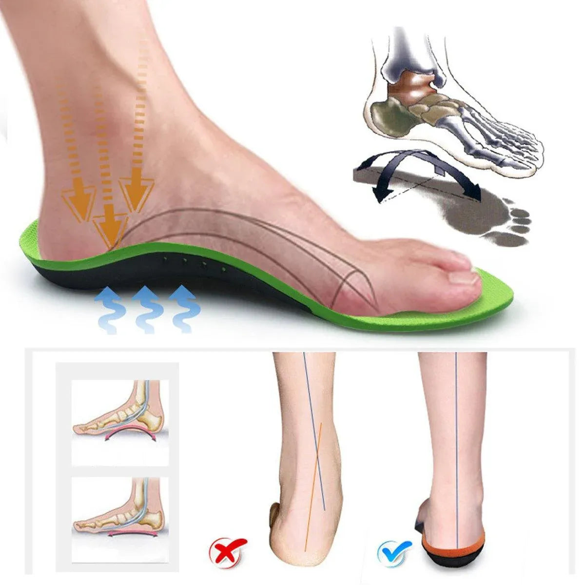 4 SizesOrthotic Insoles Arch Support for Flat Feet High Arches Plantar Fasciitis - L