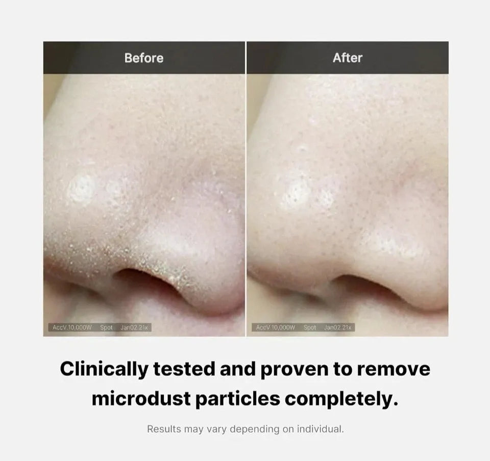 MEDICUBE Zero Foam Cleanser 120g – Deep Cleansing, Pore Care – AU Seller